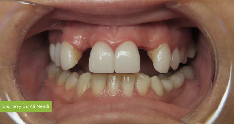 Before treatment